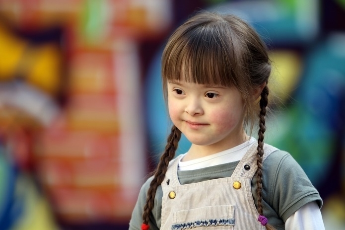 Hội chứng down | Steps Special School